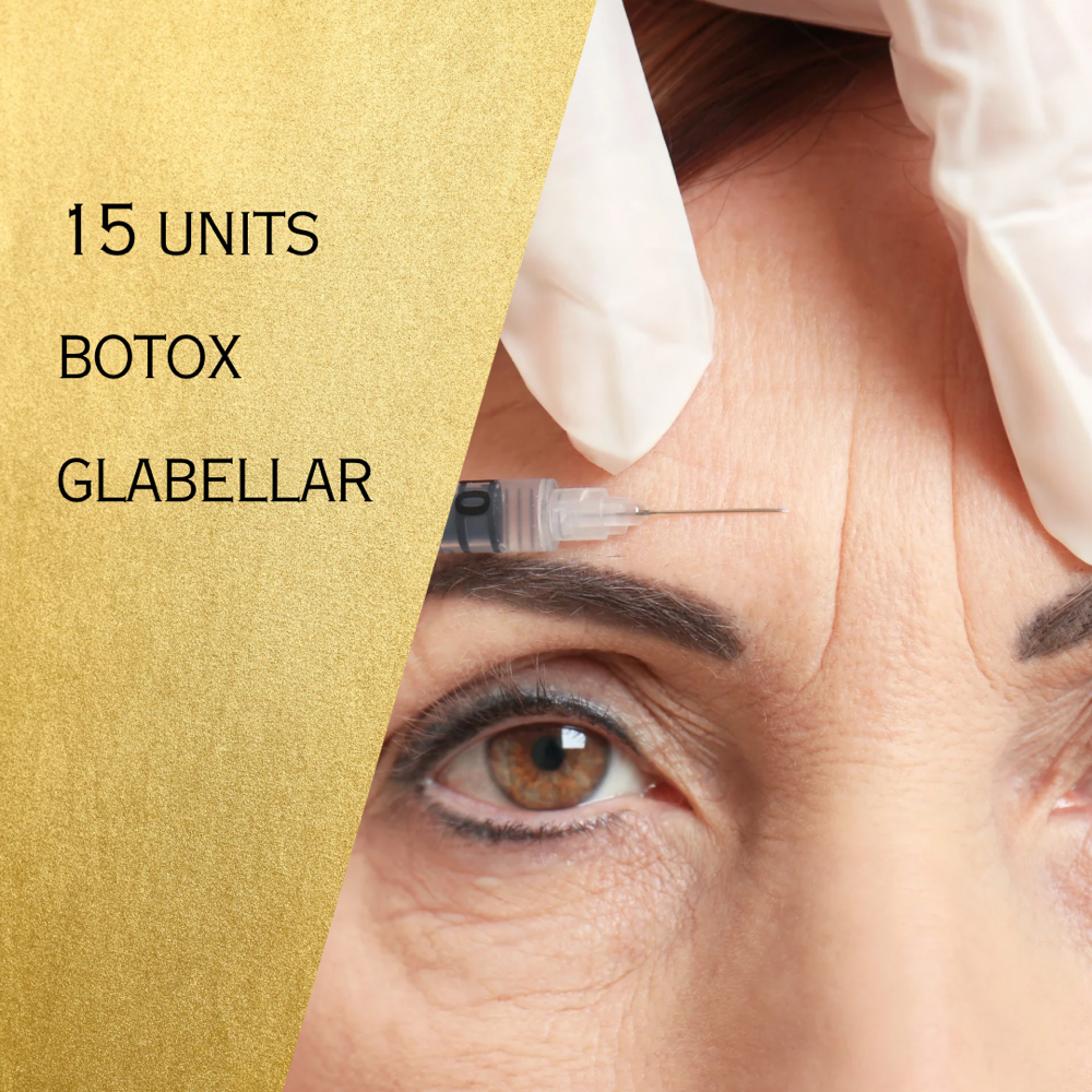 15U Botox Glabellar