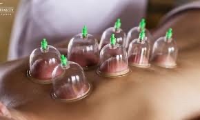 CUPPING&MASSAGE  (ONE AREA)