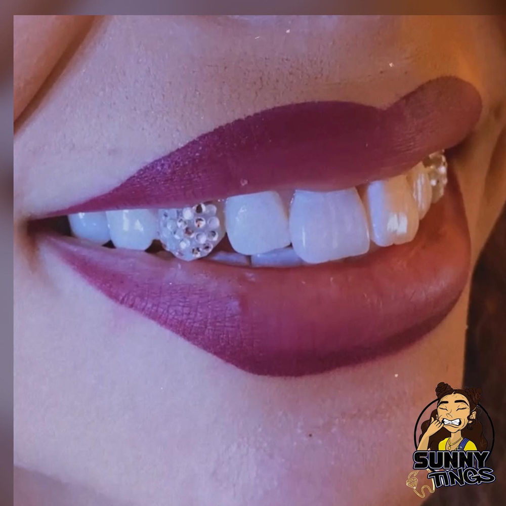 Disco Tooth at Define Davina BEAUTY in Seattle, WA
