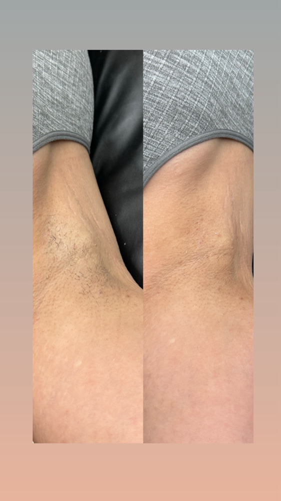 Underarm Wax