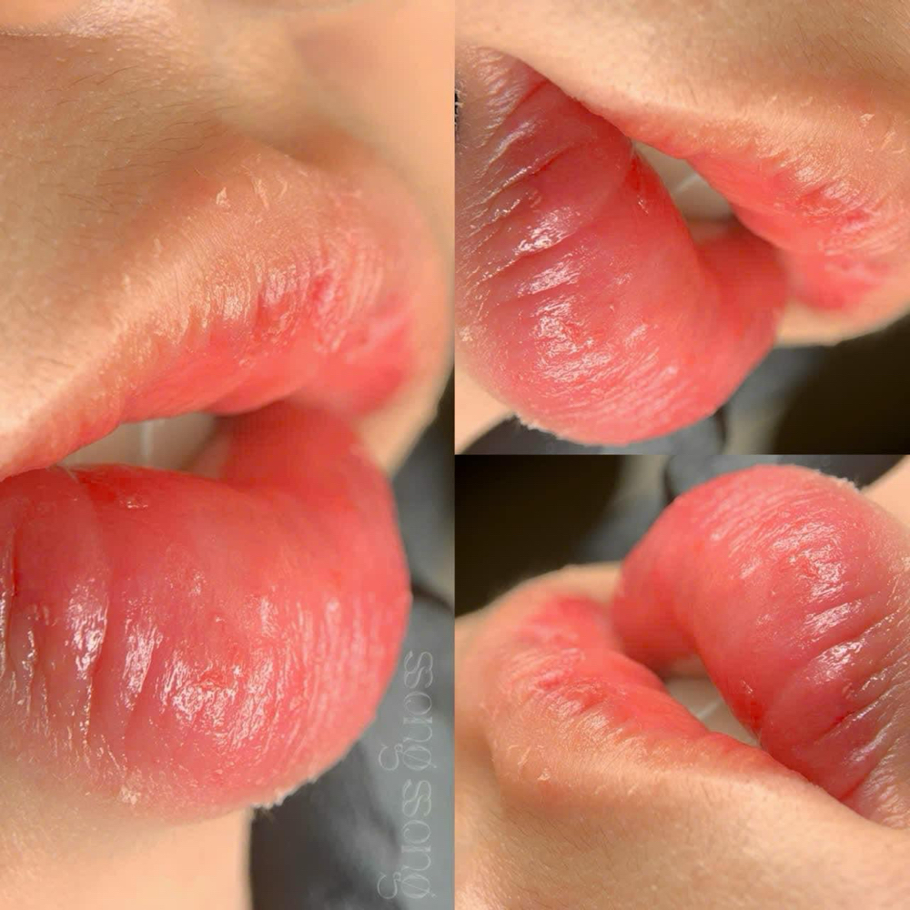 Lip Blusing Touch Up After A Month