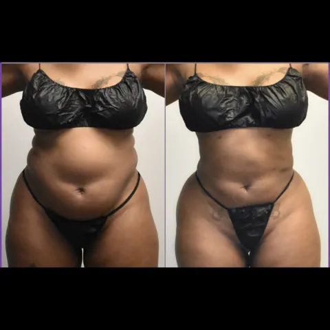 New Glam Hottie at New Glam Aesthetics Studios in Bon Air, VA
