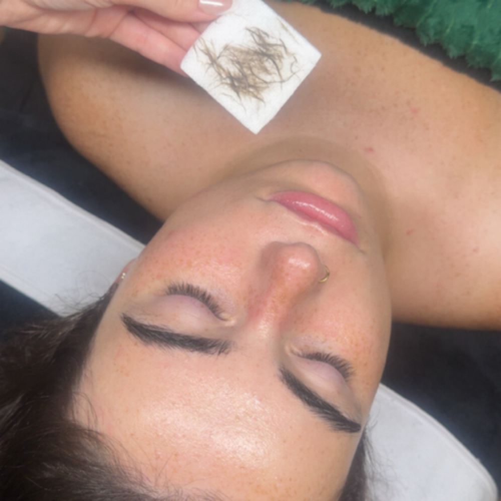 Dermaplaning Facial at KayVita Wellness Spa in Tampa, FL
