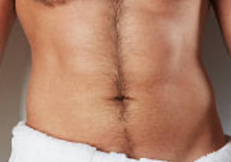 Full Stomach at LJ’s Aesthetics in Paris, ME