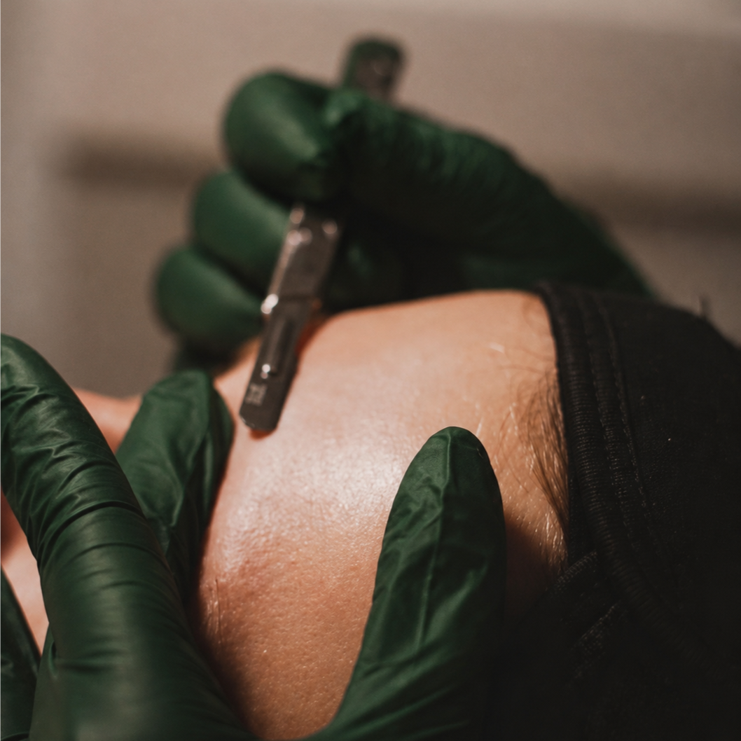 Customized Facial + Dermaplaning at Woods Body & Skin Therapy