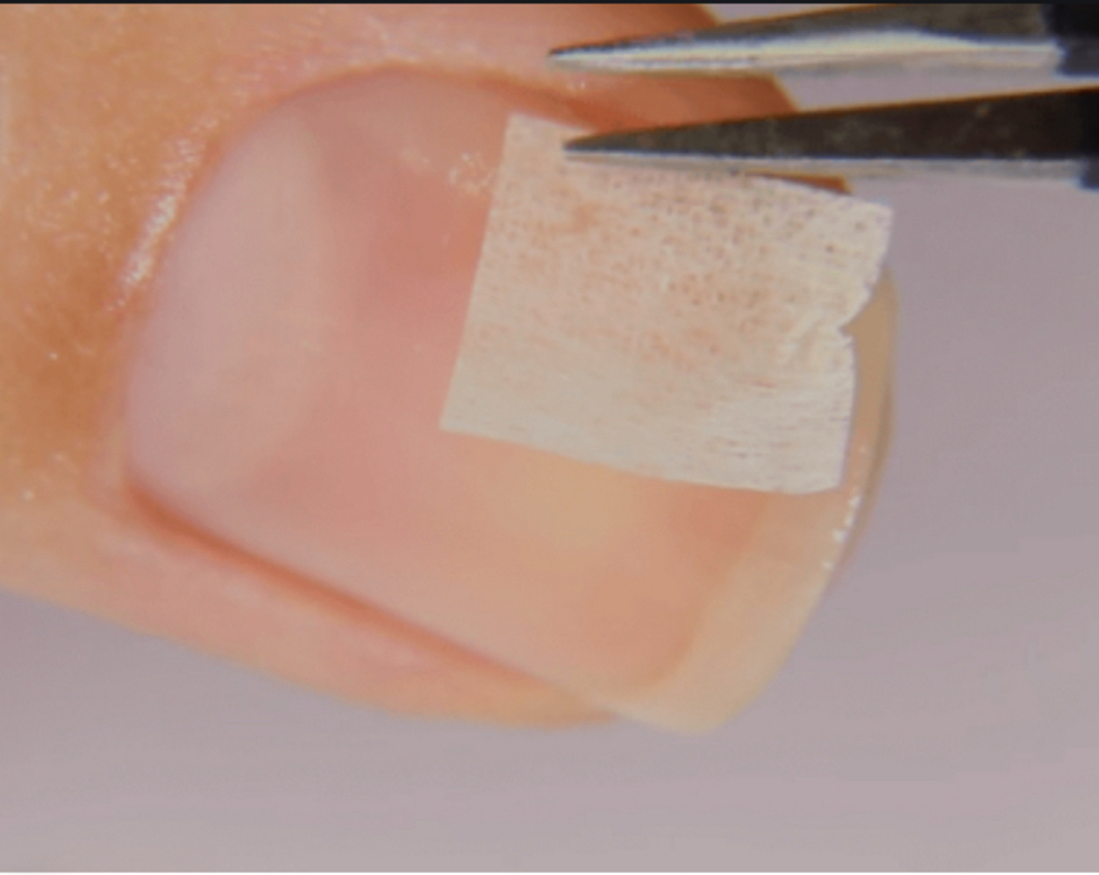 NAIL FIX (1 FINGER)