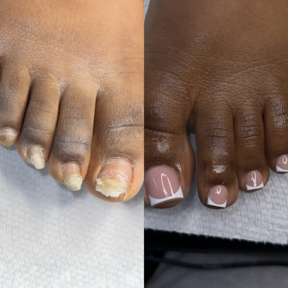 Toe Reconstruction at Slayedbyaija in Temple Hills, MD