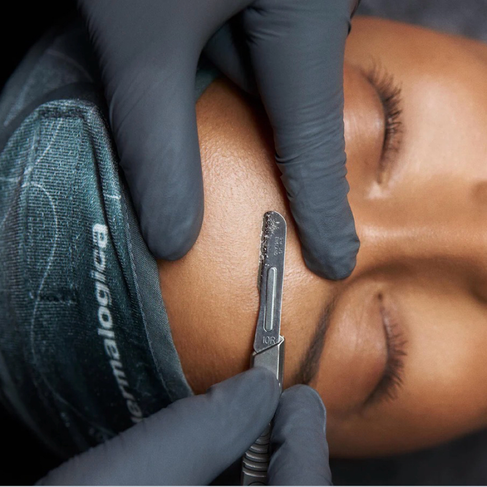 Dermaplane at KDM Derma Therapy in Centerton, AR