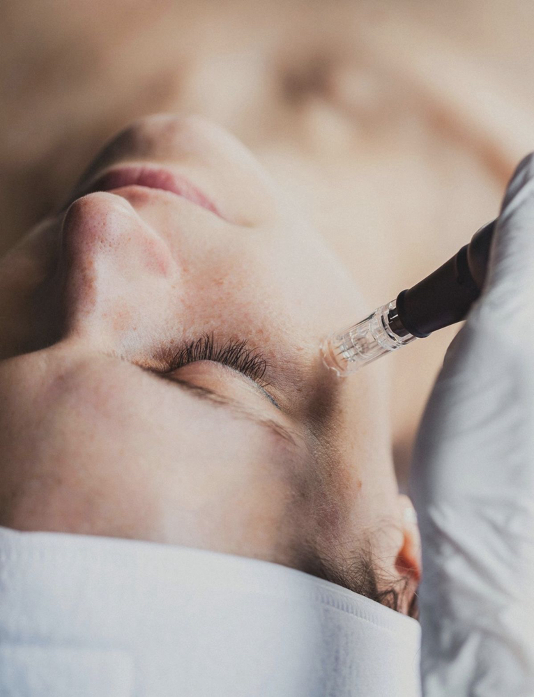 Microneedle at Dew Drop Aesthetics LLC in Fort Smith, AR