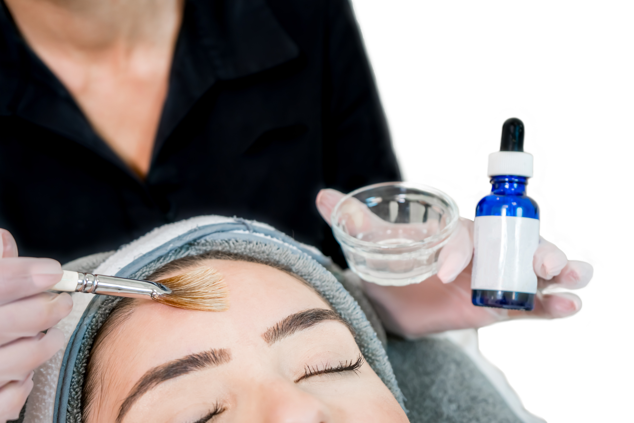 Chemical Peels