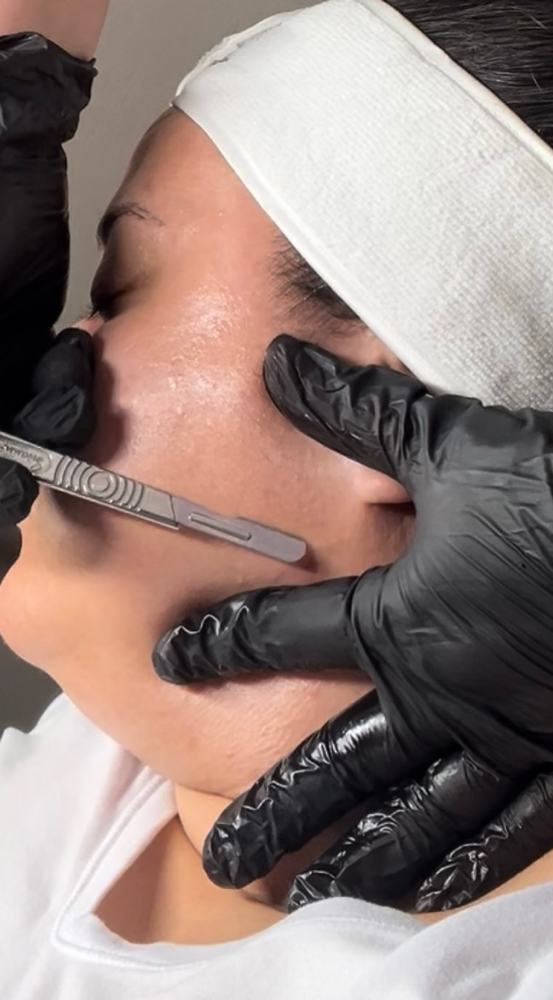 Dermaplane Facial