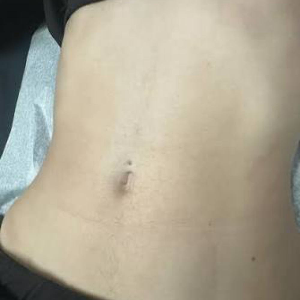 Stomach at iSugar Waxing Studio in Redondo Beach, CA