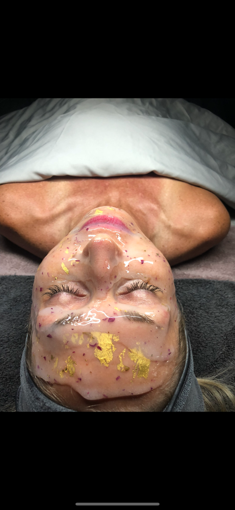 Micro-Channeling Infusion Facial