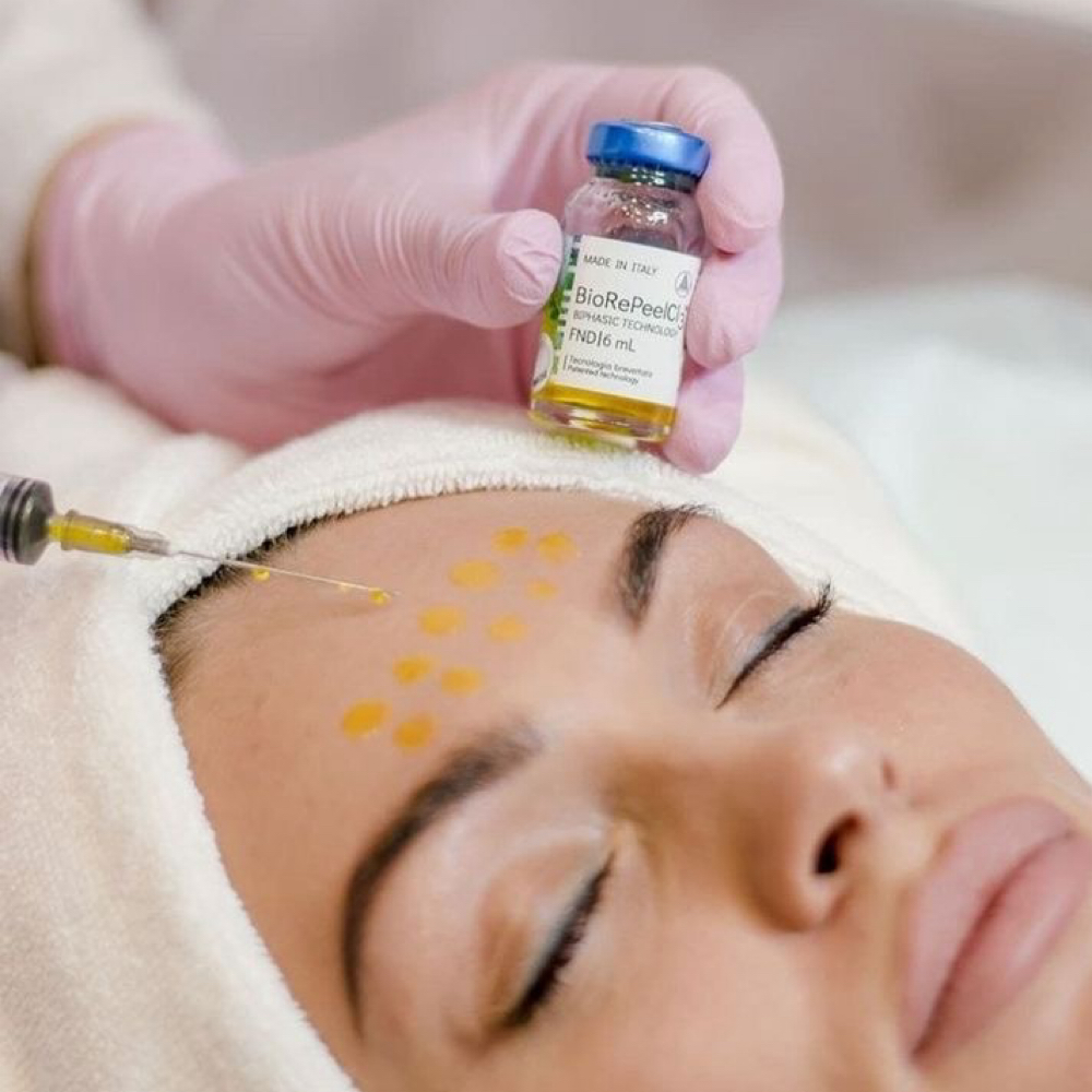Chemical Peel at Madína Beauté Studío in Las Vegas, NV