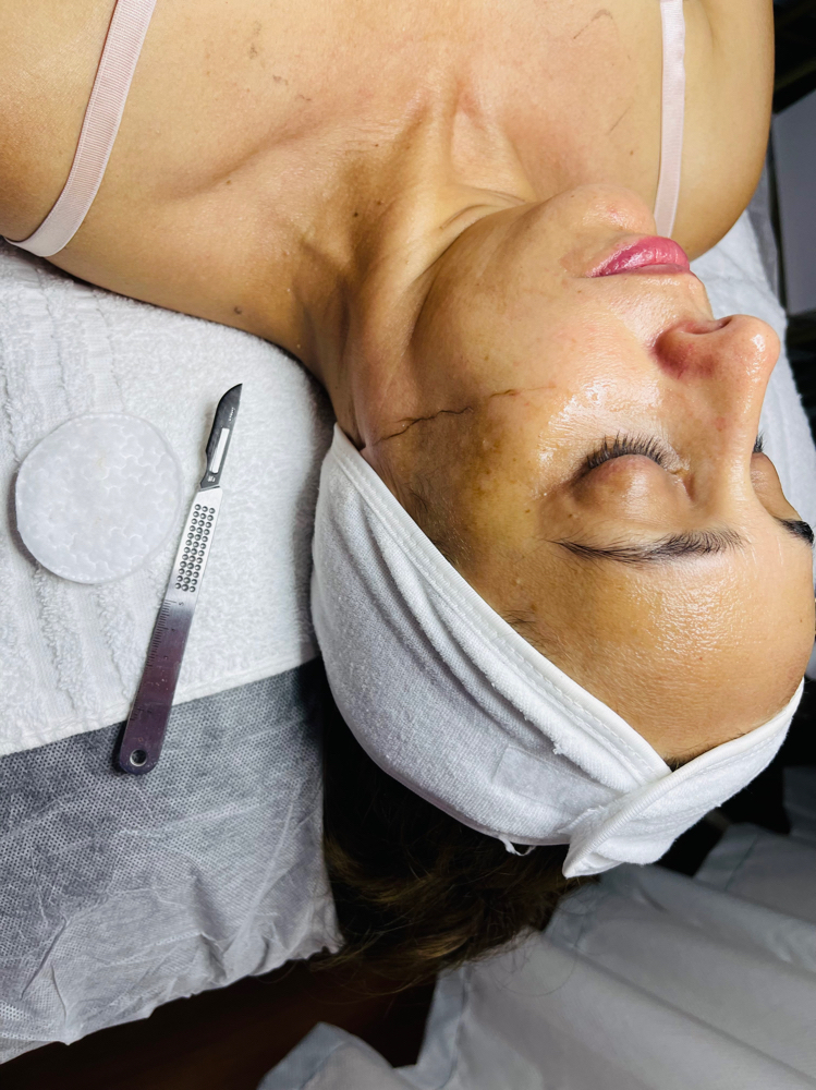 Dermaplanig
