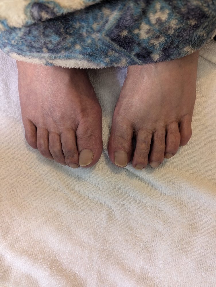 GERIATRICS  Pedicure