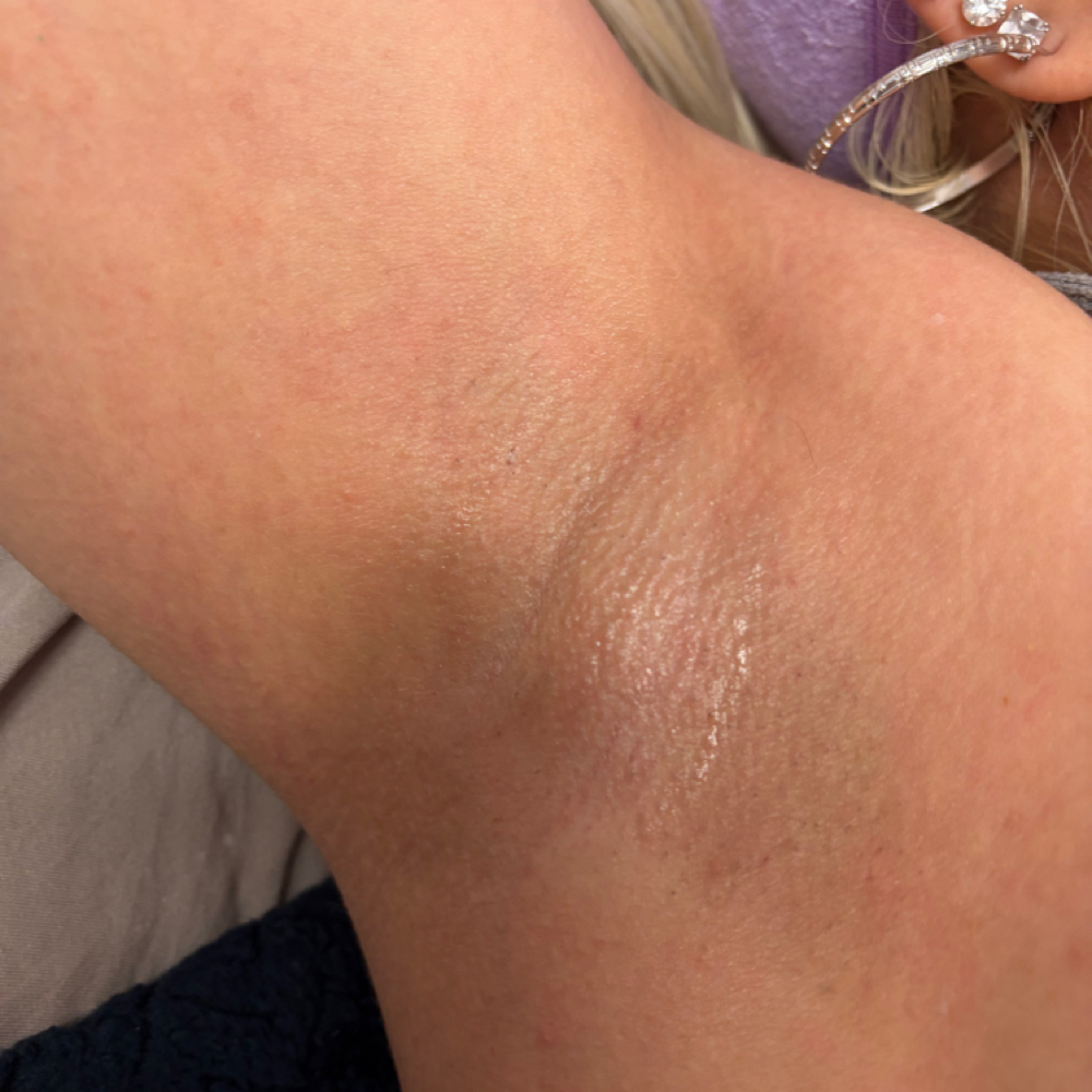 Under Arm Wax & Bleaching at Esthetics by bren in Poplar Grove, IL