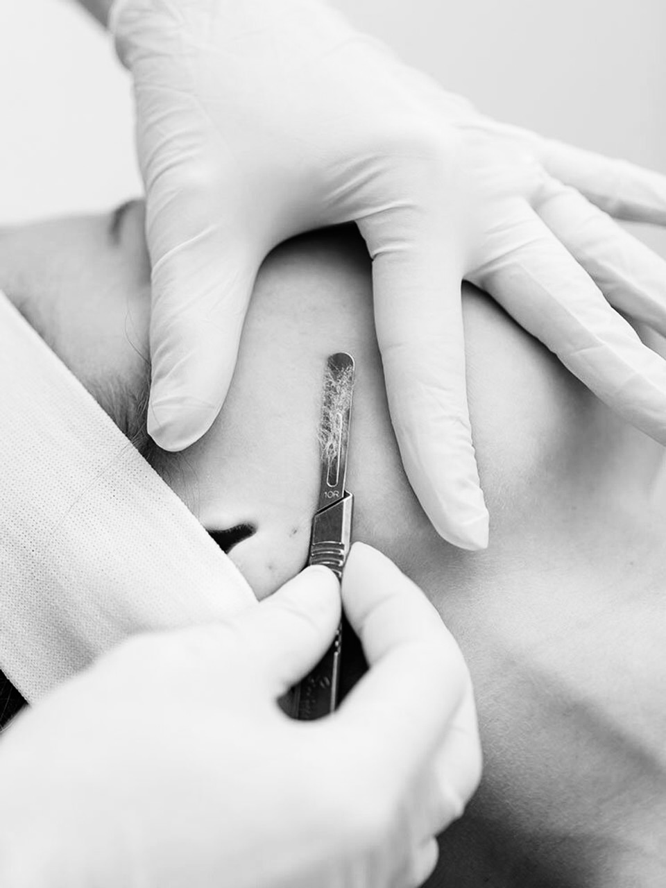 Brightening Facial with Dermaplane