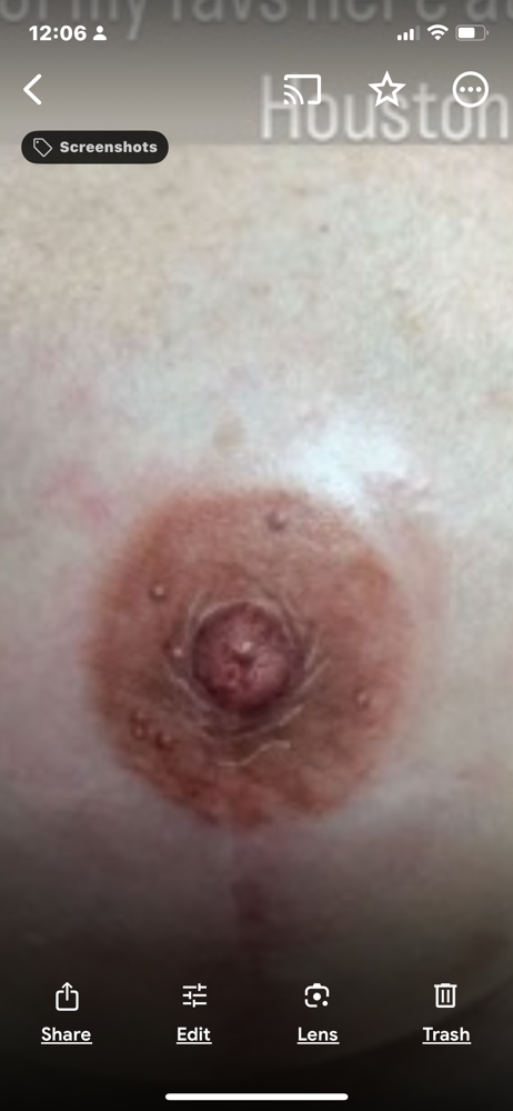 Areola Pmu Restoration at De Luxe Beauty Parlour in 93704