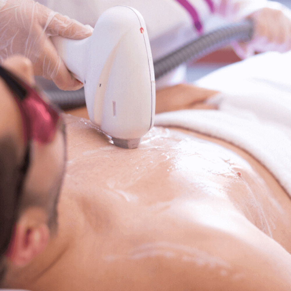 Diodo Laser (pecho) at Diana Bella LLC in Deerfield Beach, FL