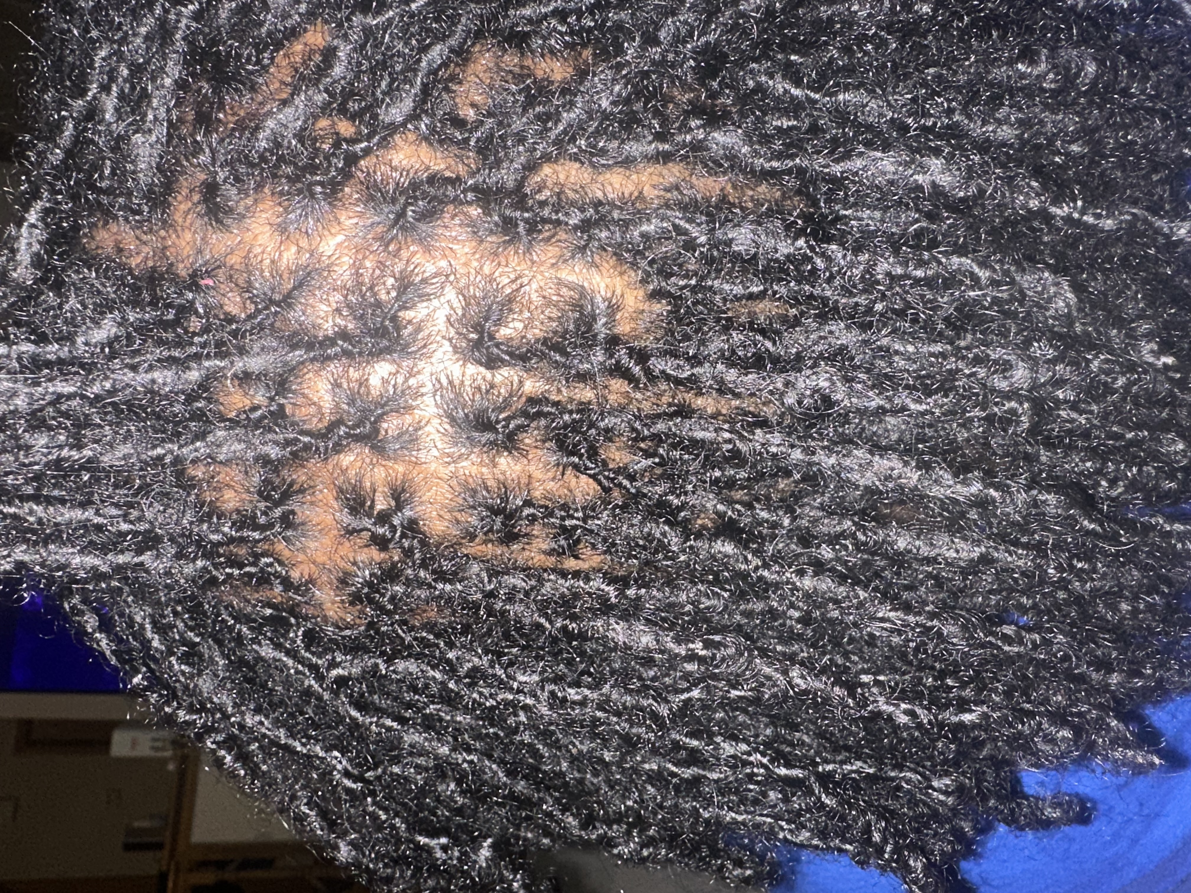 Micro Locs