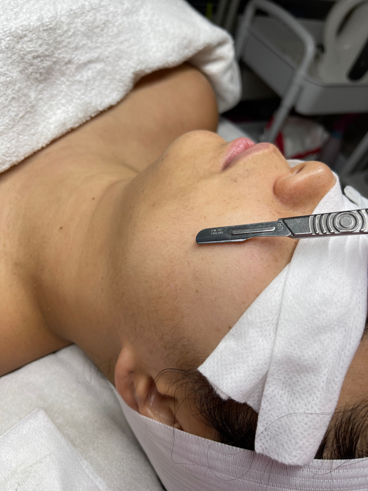 Dermaplaning Facial