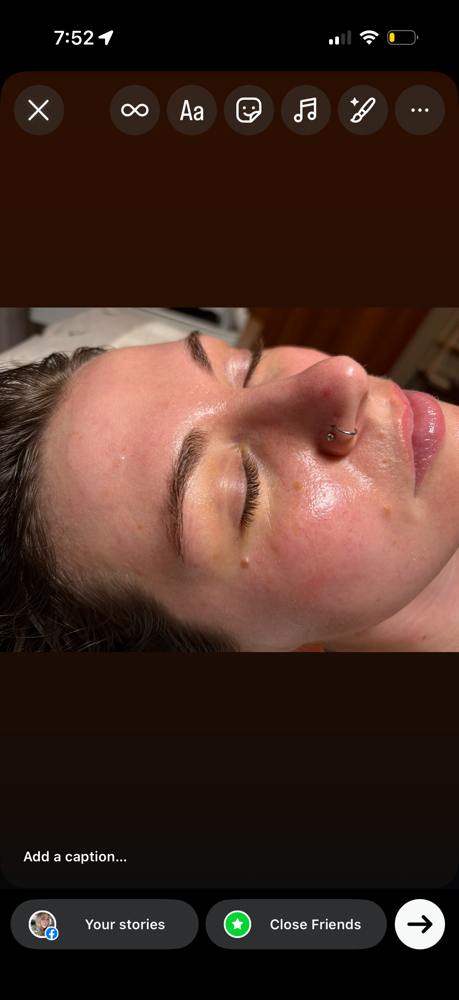 Snow Globe Glass Skin Peel