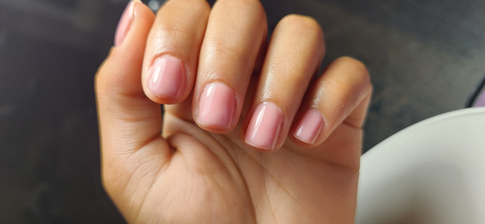 Gel Overlay