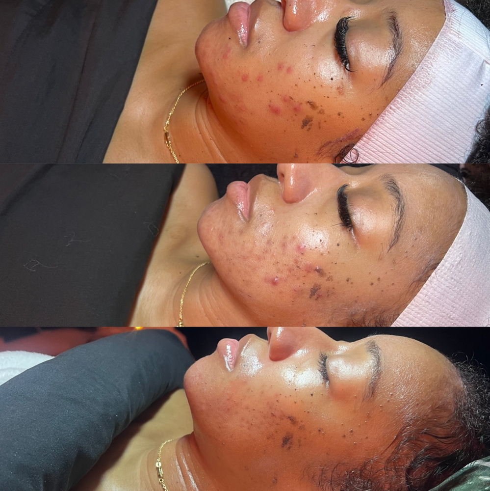 Clear Peel