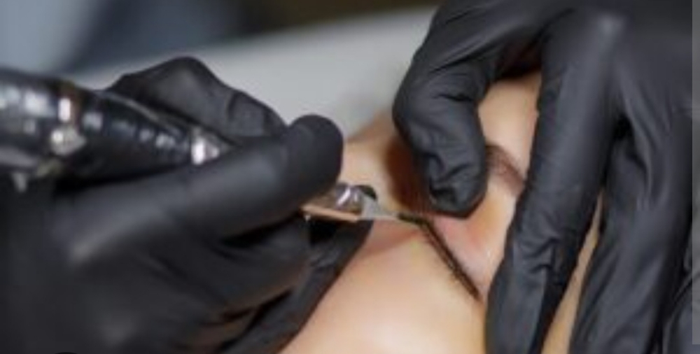Saline Tattoo Removal at Renue Spa And Wellness in Joliet, IL