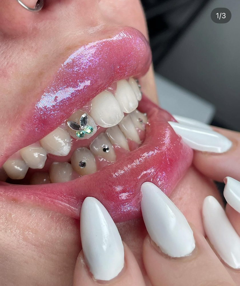 Tooth Gems 🦷💎✨
