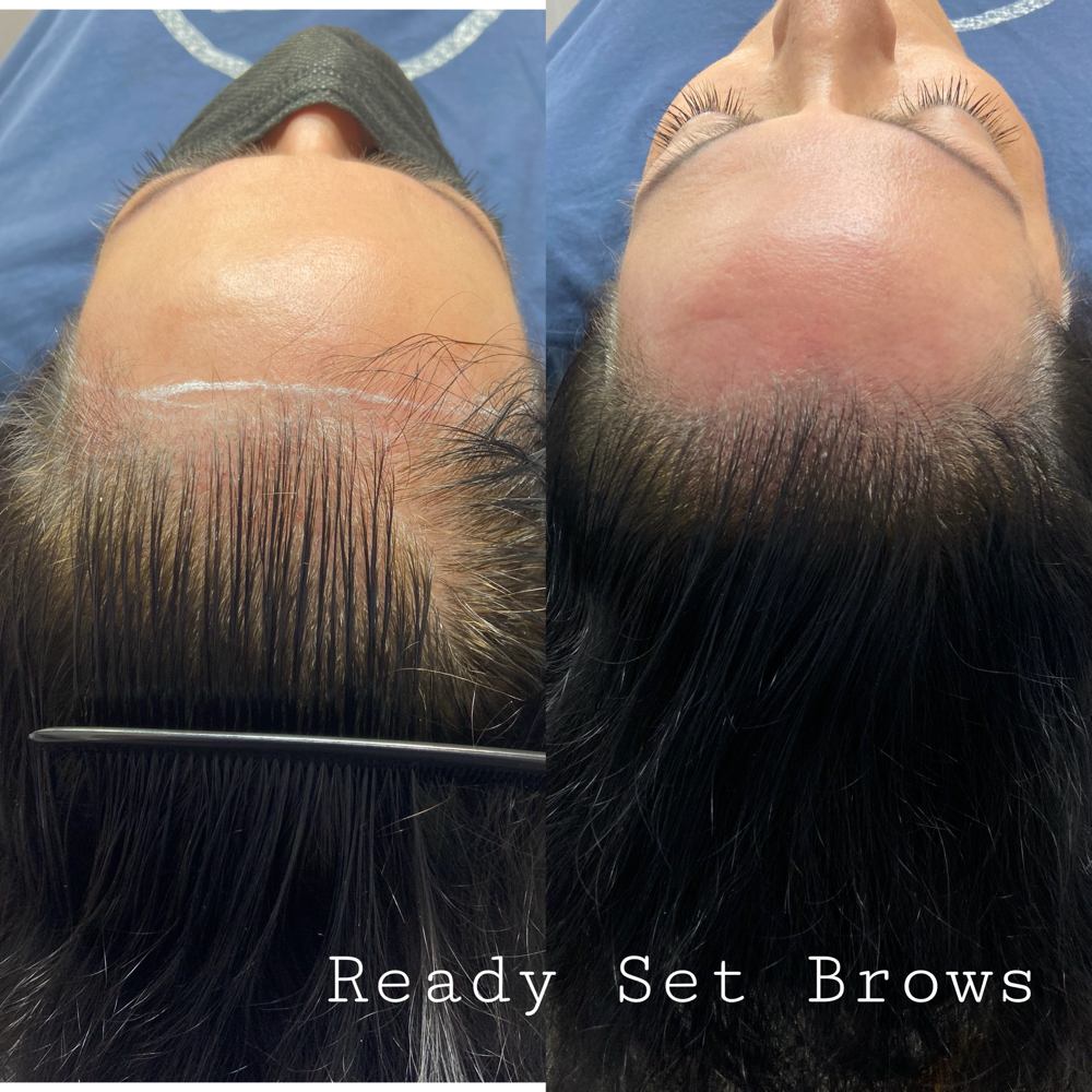 Scalp Micropigmentation Consult
