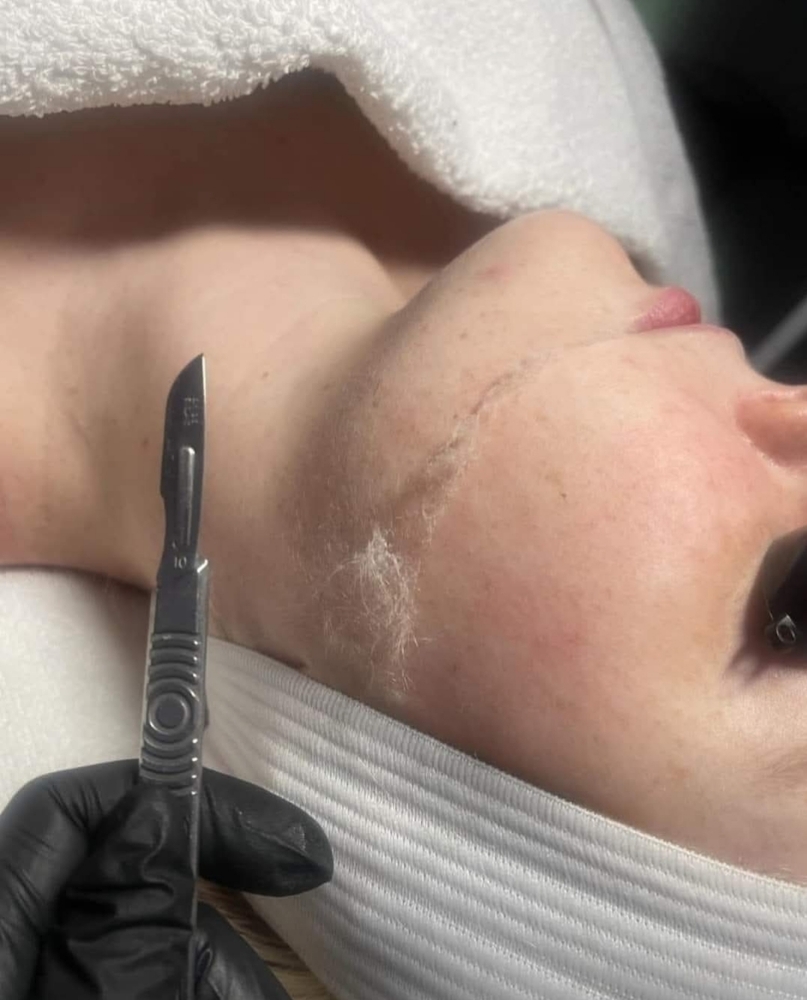 Dermaplane/Microdermabrasion Facial