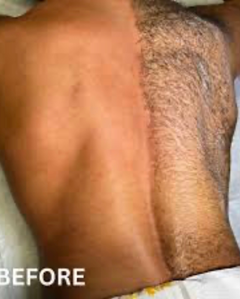 Back Wax And Back Facial at Get Frosted lux Spa in Wauchula, FL