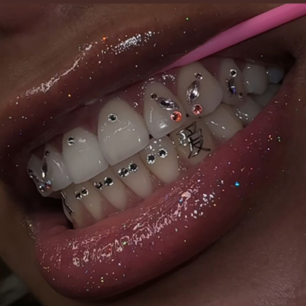 Tooth Gems at Golden Hour Esthetics & More in Warsaw, IN