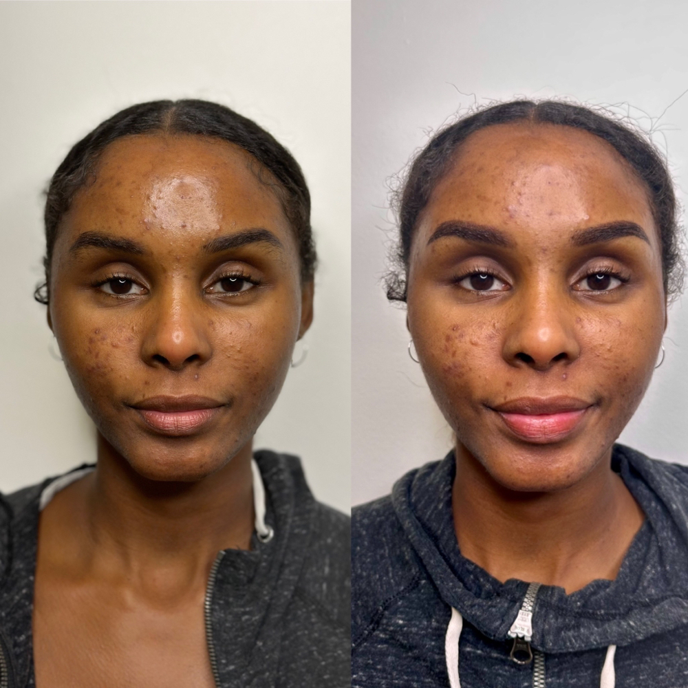 Perfecting Stage 6-8 Weeks