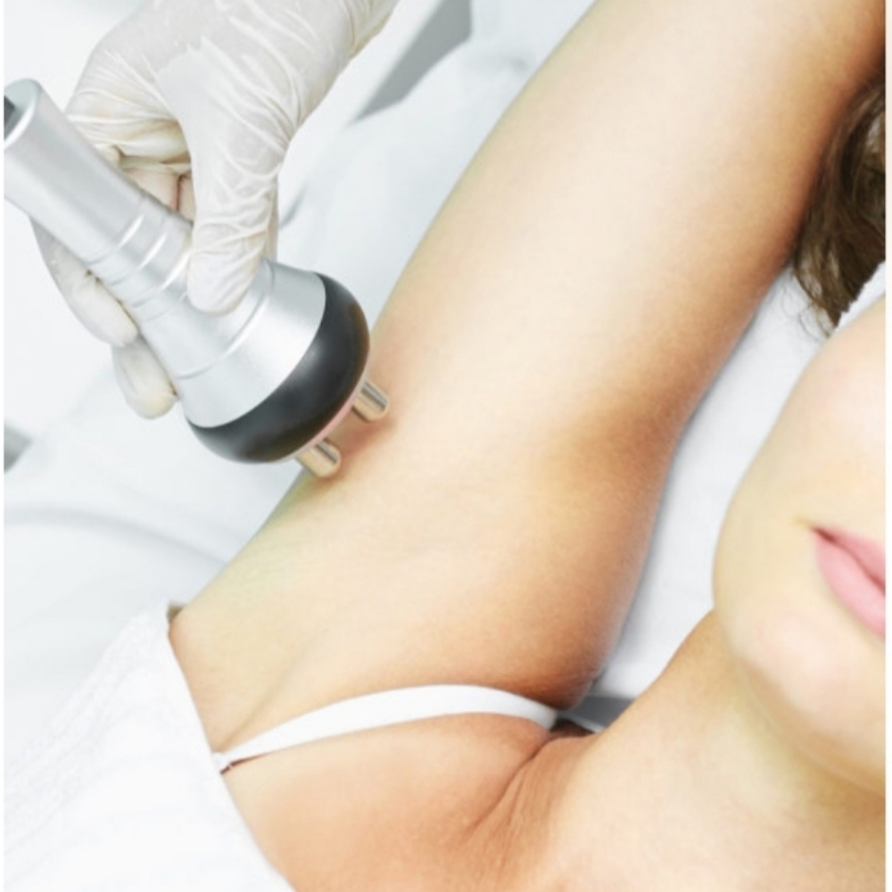 Lovinme RF Arm Sculpt at Lovinme Smoother Silhouette in Murrieta, CA