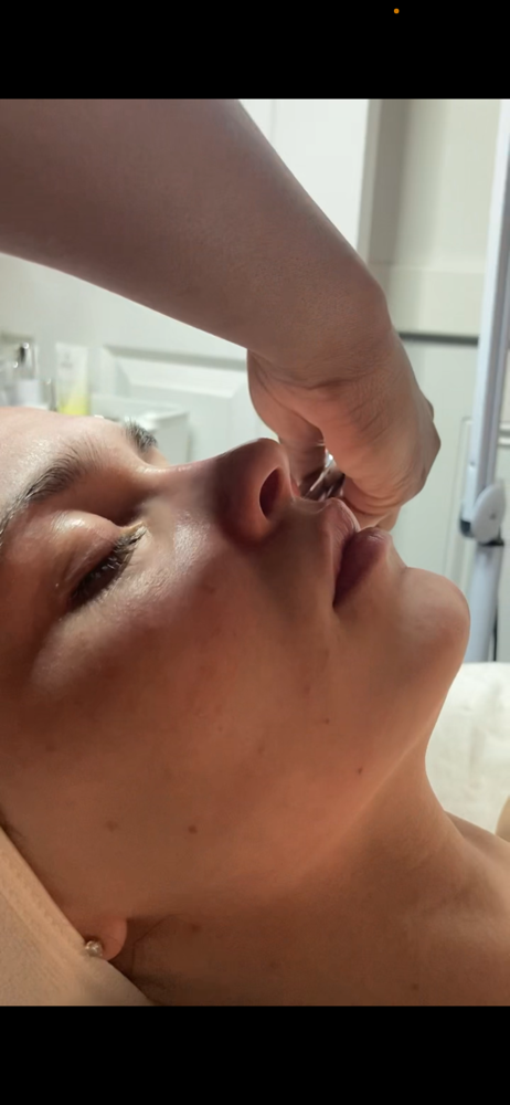 Microdermabrasion Facial