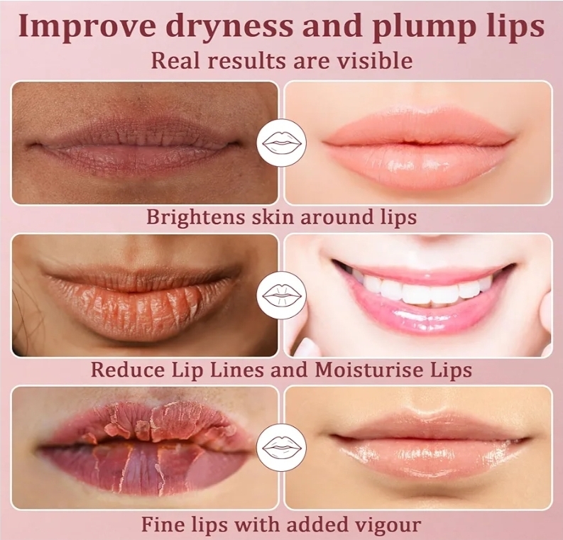 NEW!! Lip Treatment