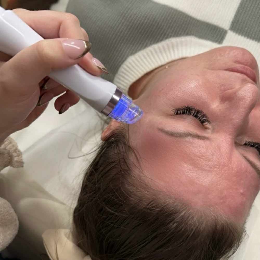 The Signature Hydro-facial at Pure Elegance Esthetics in North Andover, MA