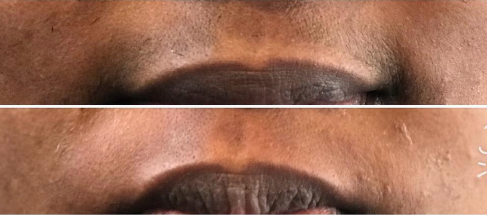 Upper Lip Wax