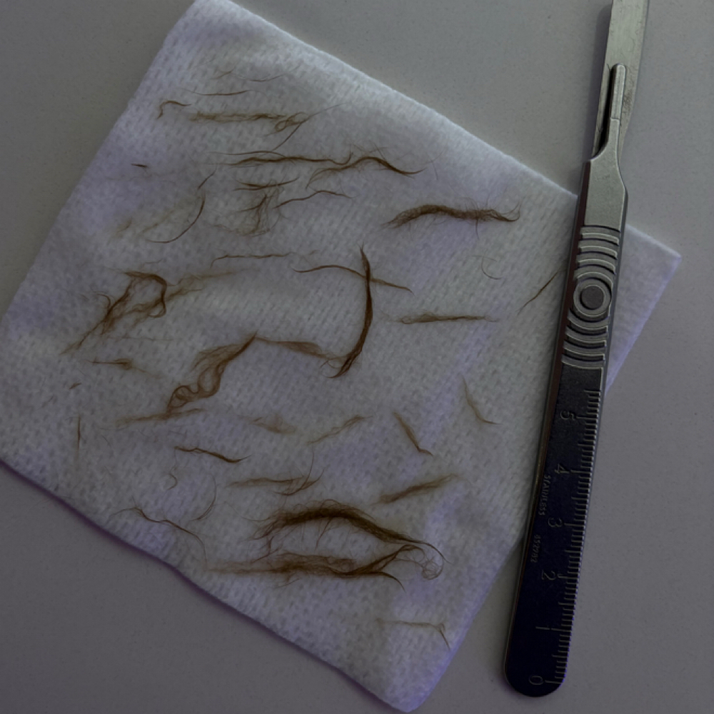 Dermaplaning Facial at SKIN by The Nest in Brea, CA