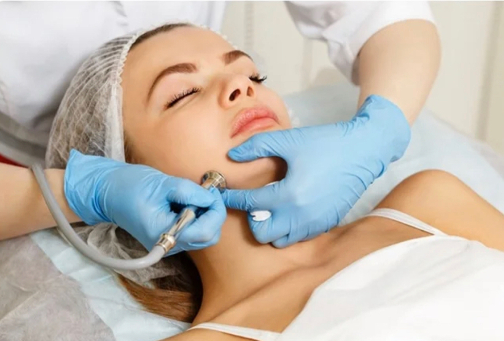 Microdermabrasion