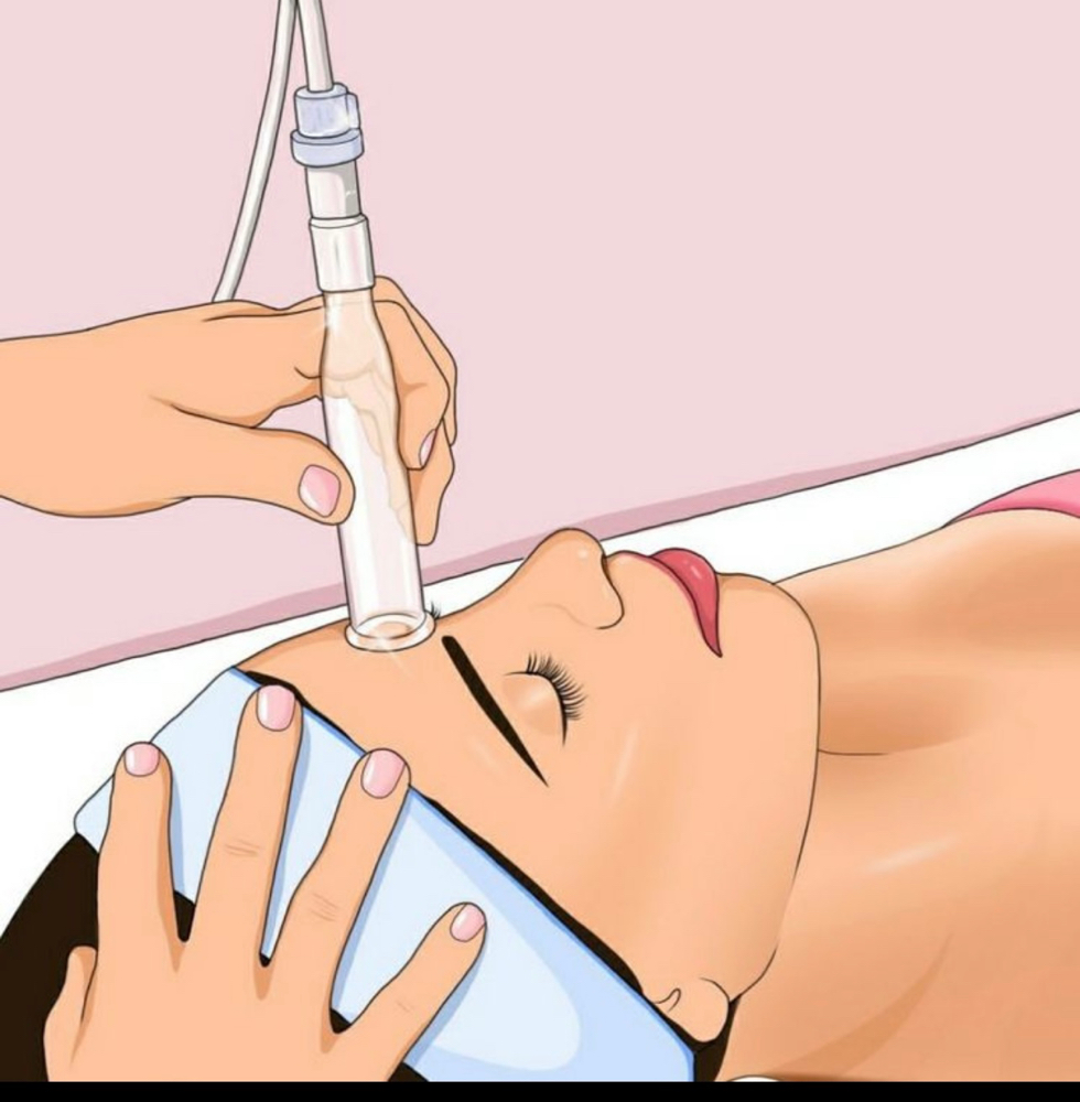 Microdermabrasion Facial