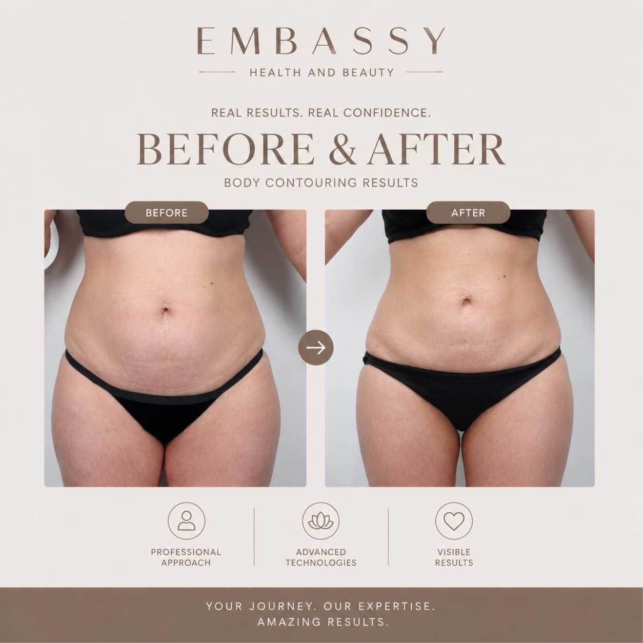 Body Marathon Advanced 2 at Embassy&health&beauty in Hallandale, FL