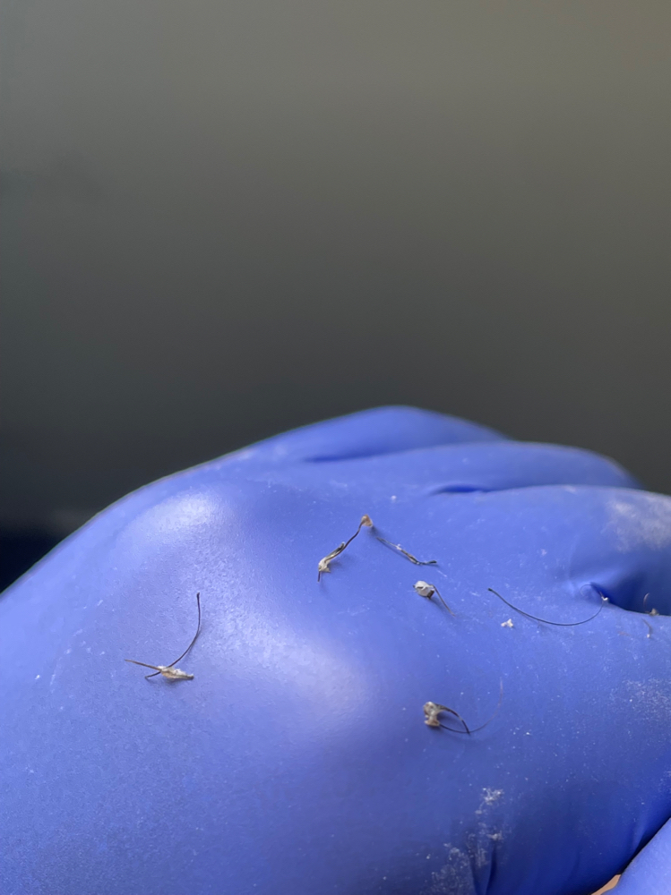 Extractions