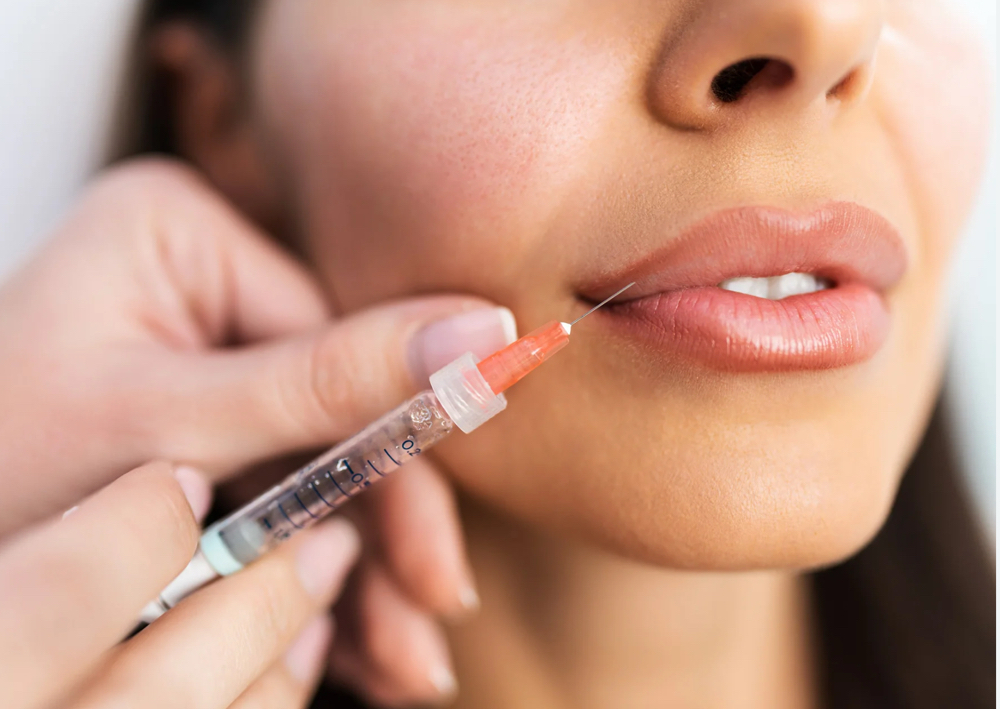 Mini Lips 1/2 Syringe Of Versa