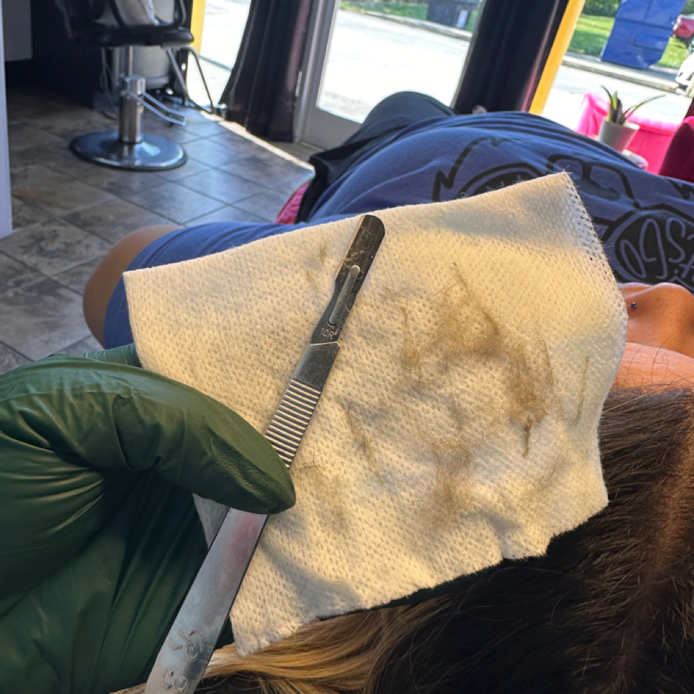 Dermaplaning at Kins N Koe in Knoxville, TN