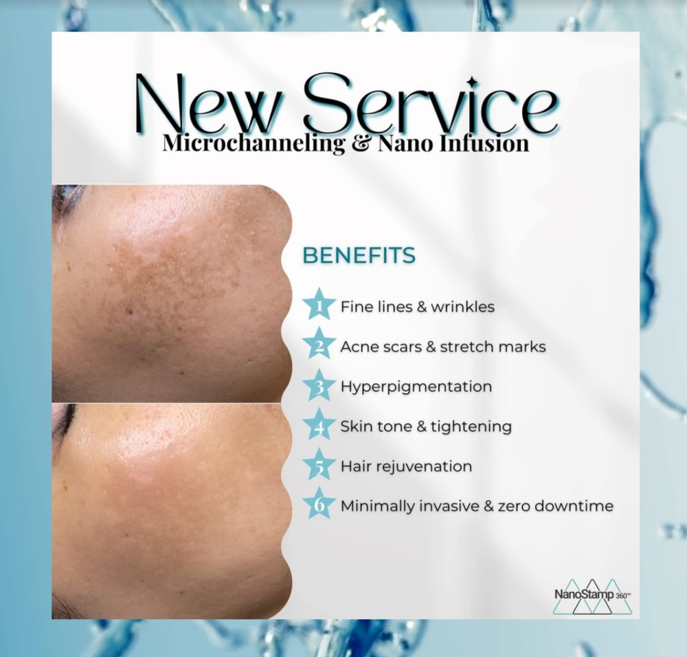 NanoStamp 360-Single Treatment