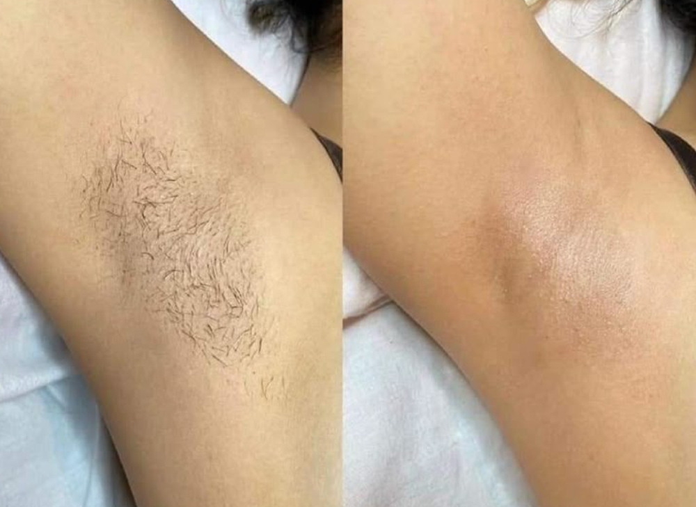 Underarm Wax